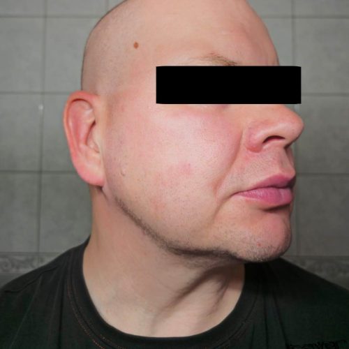 janne_jalkeen janne_jalkeen